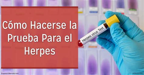 Cómo tener sexo con alguien con herpes: 10 Pasos